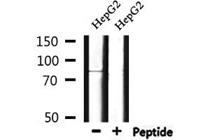 Western blot analysis of extracts from HepG2, using CCNK Antibody.
