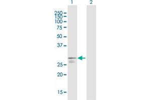 Poly(A) Binding Protein, Cytoplasmic, Pseudogene 2 (PABPCP2) (AA 1-269) antibody