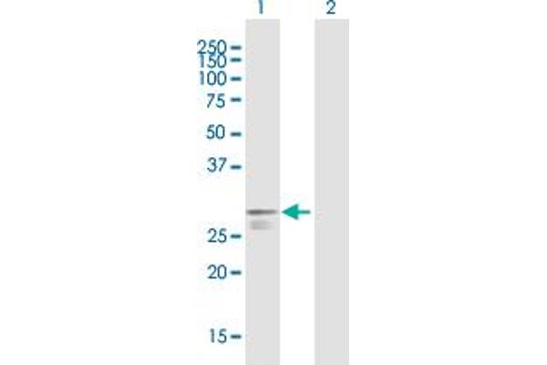 Poly(A) Binding Protein, Cytoplasmic, Pseudogene 2 (PABPCP2) (AA 1-269) antibody