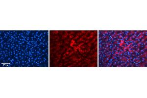 HP (haptoglobin)antibody - N-terminal region          Formalin Fixed Paraffin Embedded Tissue:  Human Liver Tissue    Observed Staining:  Cytoplasm in hepatocytes   Primary Antibody Concentration:  1:100    Secondary Antibody:  Donkey anti-Rabbit-Cy3    Secondary Antibody Concentration:  1:200    Magnification:  20X    Exposure Time:  0.