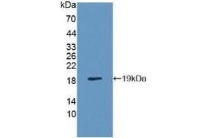 Detection of Recombinant VAPB, Human using Polyclonal Antibody to Vesicle Associated Membrane Protein Associated Protein B (VAPB)
