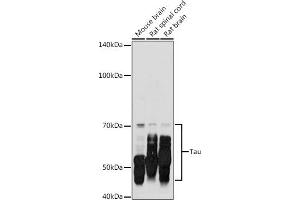 Western blot analysis of extracts of various cell lines, using Tau antibody (ABIN3021441, ABIN3021442, ABIN3021443 and ABIN6215045) at 1:500 dilution. (MAPT antibody  (AA 1-100))