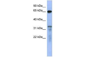 WB Suggested Anti-RAP1GAP Antibody Titration: 0. (RAP1GAP antibody  (Middle Region))