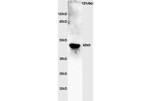 Rat brain lysates probed with Rabbit Anti-Actin Polyclonal Antibody, Unconjugated  at 1:3000 for 90 min at 37˚C. (Actin antibody  (AA 165-260))