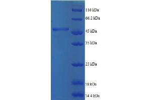 SDS-PAGE (SDS) image for ADP-Ribosylation Factor 5 (ARF5) (AA 2-180) protein (GST tag) (ABIN5712091)