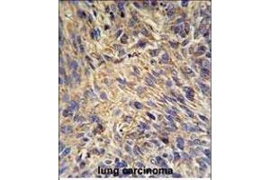 Immunohistochemistry (Paraffin-embedded Sections) (IHC (p)) image for anti-Heat Shock Protein 90kDa beta (Grp94), Member 1 (HSP90B1) (AA 16-43), (N-Term) antibody (ABIN651092)