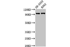 Western Blot Positive WB detected in: SH-SY5Y whole cell lysate, K562 whole cell lysate All lanes: KCNQ3 antibody at 3 μg/mL Secondary Goat polyclonal to rabbit IgG at 1/50000 dilution Predicted band size: 97, 85 kDa Observed band size: 97 kDa (KCNQ3 antibody  (AA 763-872))