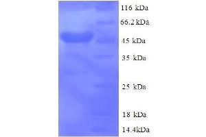 SDS-PAGE (SDS) image for Canopy 2 Homolog (CNPY2) (AA 22-182), (full length) protein (GST tag) (ABIN1047579)