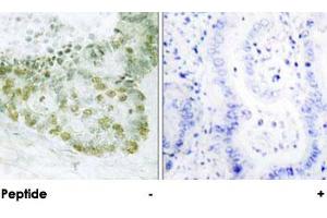 Immunohistochemical analysis of paraffin-embedded human heart tissue using TGFB1I1 polyclonal antibody . (TGFB1I1 antibody)