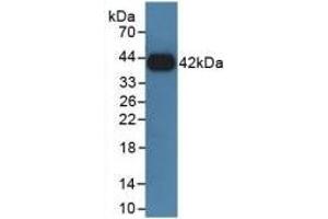 Detection of Recombinant GHR, Rat using Polyclonal Antibody to Growth Hormone Receptor (GHR) (Growth Hormone Receptor antibody  (AA 353-588))