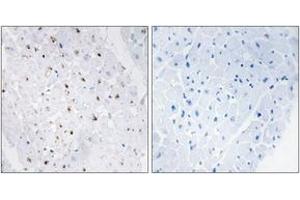 Immunohistochemistry analysis of paraffin-embedded human heart, using Bloom Syndrome (Phospho-Thr99) Antibody. (Bloom Syndrome (AA 65-114), (pThr99) antibody)