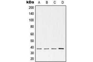 Western blot analysis of cTnT expression in H9 (A), 4T1 (B), human heart (C) whole cell lysates. (Cardiac Troponin T2 antibody  (Center))