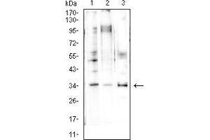 Western Blotting (WB) image for anti-Cyclin D1 (CCND1) (AA 1-295) antibody (ABIN7193695)