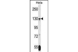Western blot analysis in Hela cell line lysates (35ug/lane). (TNKS antibody  (N-Term))