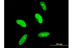 Immunofluorescence of monoclonal antibody to MAGED2 on HeLa cell. (MAGED2 antibody  (AA 16-125))