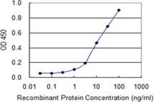 Detection limit for recombinant GST tagged WT1 is 0. (WT1 antibody  (AA 349-439))