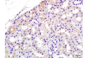 Formalin-fixed and paraffin embedded rat kidney labeled with Rabbit Anti APAF1(NT) Polyclonal Antibody, Unconjugated (ABIN724310) at 1:200 followed by conjugation to the secondary antibody and DAB staining (APAF1 antibody  (AA 13-80))