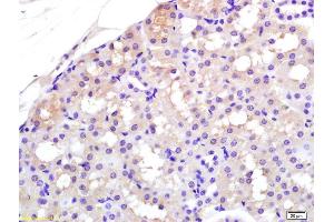 Formalin-fixed and paraffin embedded rat kidney labeled with Rabbit Anti APAF1(NT) Polyclonal Antibody, Unconjugated (ABIN724310) at 1:200 followed by conjugation to the secondary antibody and DAB staining (APAF1 antibody  (AA 13-80))