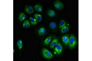 Immunofluorescent analysis of A549 cells using ABIN7175571 at dilution of 1:100 and Alexa Fluor 488-congugated AffiniPure Goat Anti-Rabbit IgG(H+L) (CACNG3 antibody  (AA 235-315))