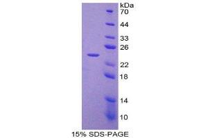 SDS-PAGE (SDS) image for Laminin, beta 3 (LAMB3) (AA 595-778) protein (His tag) (ABIN2125597) (Laminin beta 3 Protein (AA 595-778) (His tag))