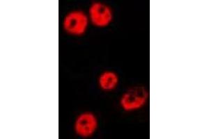ABIN6275487 staining HepG2 by IF/ICC. (RBBP5 antibody  (Internal Region))