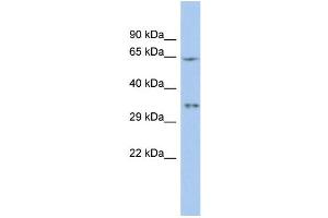 WB Suggested Anti-MIF4GD Antibody Titration:  0.