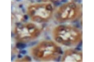 Used in DAB staining on fromalin fixed paraffin-embedded Kidney tissue (Laminin alpha 1 antibody  (AA 886-1039))