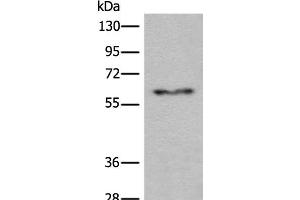 Western blot analysis of Human fetal liver tissue lysate using CES2 Polyclonal Antibody at dilution of 1:600 (CES2 antibody)