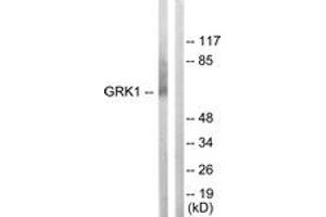 Western blot analysis of extracts from COLO205 cells, using GRK1 (Ab-21) Antibody. (GRK1 antibody  (AA 6-55))