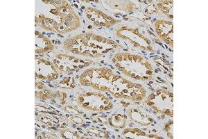 Immunohistochemistry of paraffin-embedded human kidney using GSTT1 antibody at dilution of 1:200 (x400 lens) (GSTT1 antibody  (AA 1-240))