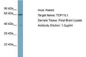 Host: Rabbit Target Name: TCP11L1 Sample Type: Fetal Brain lysates Antibody Dilution: 1. (TCP11L1 antibody  (C-Term))