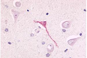 Anti-GPR17 antibody  ABIN1048752 IHC staining of human brain, neurons and glia. (GPR17 antibody  (N-Term))