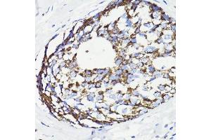 Immunohistochemistry of paraffin-embedded rat spleen using PDCD10 antibody (ABIN7269540) at dilution of 1:100 (40x lens). (PDCD10 antibody  (AA 1-212))