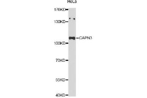 Western blot analysis of extracts of HeLa cells, using CAPN3 Antibody (ABIN5997360) at 1:3000 dilution. (Calpain 3 antibody)