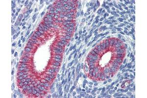 Human uterus; Anti-ZNF71 antibody IHC staining of human uterus. (ZNF71 antibody)