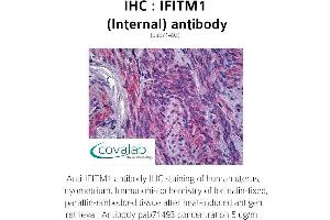 Image no. 1 for anti-Interferon-Induced Transmembrane Protein 1 (IFITM1) (Internal Region) antibody (ABIN1735772) (IFITM1 antibody  (Internal Region))