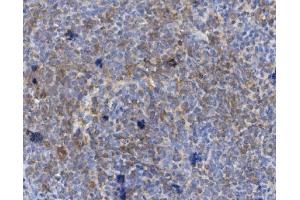IHC analysis of CD72 using anti-CD72 antibody (ABIN7602483). (CD72 antibody  (AA 8-346))