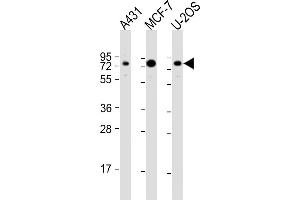 All lanes : Anti-BAG3 Antibody (N-Term) at 1:2000 dilution Lane 1: A431 whole cell lysate Lane 2: MCF-7 whole cell lysate Lane 3: U-2OS whole cell lysate Lysates/proteins at 20 μg per lane. (BAG3 antibody  (AA 31-62))