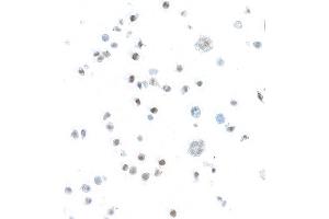 Immunocytochemistry (ICC) image for anti-Signal Transducer and Activator of Transcription 5B (STAT5B) (AA 737-787) antibody (ABIN7455110)