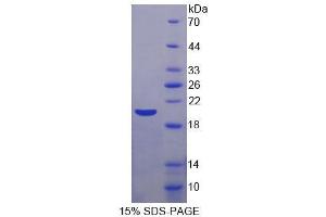 SDS-PAGE (SDS) image for alpha-Methylacyl-CoA Racemase (AMACR) (AA 2-148) protein (His tag) (ABIN4990829)