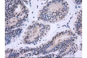 Image no. 8 for anti-Nonhomologous End-Joining Factor 1 (NHEJ1) antibody (ABIN1499729) (NHEJ1 antibody)