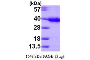 SDS-PAGE (SDS) image for HUS1 Checkpoint Homolog (S. Pombe) (HUS1) (AA 1-280) protein (His tag) (ABIN667288) (HUS1 Protein (AA 1-280) (His tag))