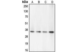 Western blot analysis of Caspase 7 expression in PC12 (A), Jurkat (B), HeLa (C), HEK293T (D) whole cell lysates. (Caspase 7 antibody  (N-Term))