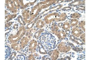 SLC16A8 antibody was used for immunohistochemistry at a concentration of 4-8 ug/ml to stain Epithelial cells of renal tubule (arrows) in Human Kidney. (MCT3 antibody)