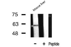 Western Blotting (WB) image for anti-Cytochrome P450, Family 2, Subfamily E, Polypeptide 1 (CYP2E1) (Internal Region) antibody (ABIN6261170)