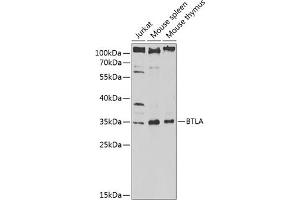 Western blot analysis of extracts of various cell lines, using BTLA antibody (ABIN6129970, ABIN6137689, ABIN6137691 and ABIN6217450) at 1:1000 dilution.