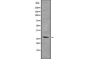 Western blot analysis of RPA30 using COLO205 whole cell lysates (RPA4 antibody  (Internal Region))