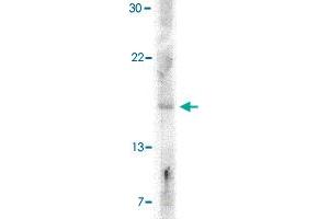 Western blot analysis of IFNB1 in A-20 cell lysate with IFNB1 polyclonal antibody  at 5 ug/mL . (IFNB1 antibody  (Internal Region))