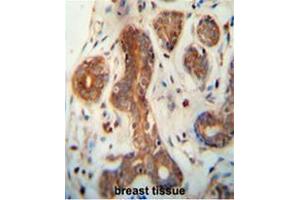 CEPT1 antibody (N-term) immunohistochemistry analysis in formalin fixed and paraffin embedded human breast tissue followed by peroxidase conjugation of the secondary antibody and DAB staining. (CEPT1 antibody  (N-Term))