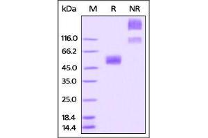 Rabbit CD47, Fc Tag on SDS-PAGE under reducing (R) and no-reducing (NR) conditions. (CD47 Protein (CD47) (AA 19-139) (Fc Tag))
